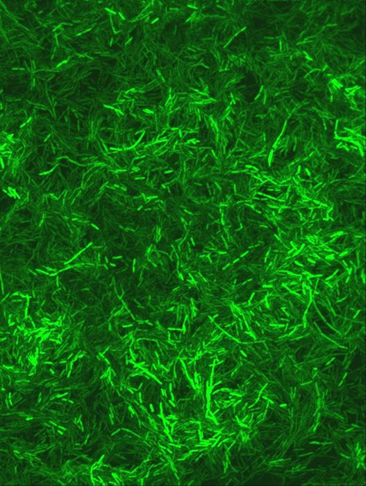 The same Pseudomonas aeruginosa bacteria looks very different with a green fluorescent protein The same Pseudomonas aeruginosa bacteria looks very different with a green fluorescent protein